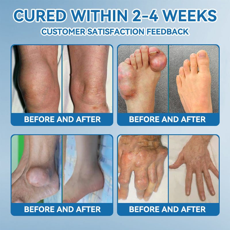 🇦🇺🫒LOVILDS™𝐁𝐏𝐂-𝟏𝟓𝟕 𝐉𝐨𝐢𝐧𝐭 𝐇𝐞𝐚𝐥𝐢𝐧𝐠 𝐂𝐫𝐞𝐚𝐦🦴Treats Arthritis, Neuropathy, Rheumatism, Sports Injuries & More🏆