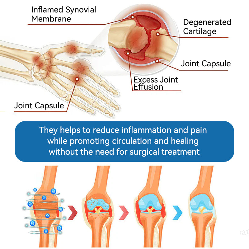 🇦🇺🫒LOVILDS™𝐁𝐏𝐂-𝟏𝟓𝟕 𝐉𝐨𝐢𝐧𝐭 𝐇𝐞𝐚𝐥𝐢𝐧𝐠 𝐂𝐫𝐞𝐚𝐦🦴Treats Arthritis, Neuropathy, Rheumatism, Sports Injuries & More🏆