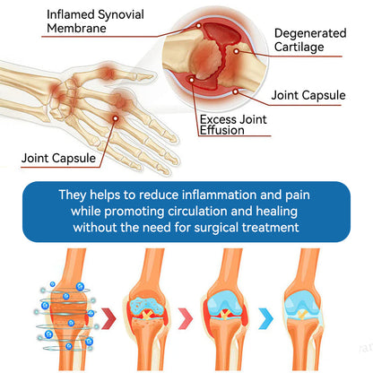 🇦🇺🫒LOVILDS™𝐁𝐏𝐂-𝟏𝟓𝟕 𝐉𝐨𝐢𝐧𝐭 𝐇𝐞𝐚𝐥𝐢𝐧𝐠 𝐂𝐫𝐞𝐚𝐦🦴Treats Arthritis, Neuropathy, Rheumatism, Sports Injuries & More🏆