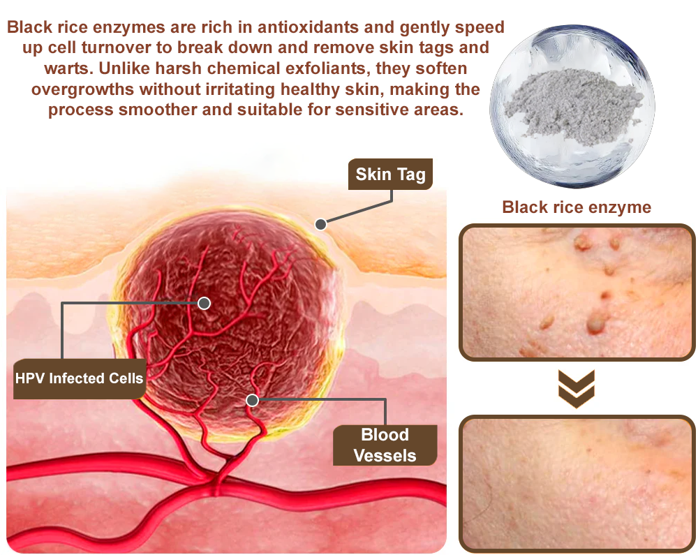 LOVILDS™Black Rice Skin Repair Essence Cream ⚕️ Health Canada Certified Certified (Eliminates warts and skin tags, relieves psoriasis, improves keratin build-up and follicular keratinization, fades pigmentation, sun spots & age spots)