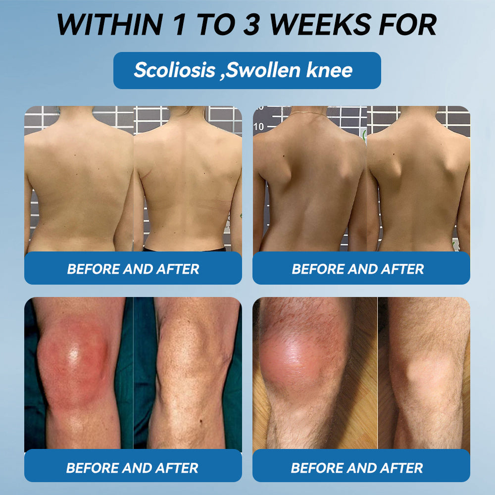 🇦🇺🫒LOVILDS™𝐁𝐏𝐂-𝟏𝟓𝟕 𝐉𝐨𝐢𝐧𝐭 𝐇𝐞𝐚𝐥𝐢𝐧𝐠 𝐂𝐫𝐞𝐚𝐦🦴Treats Arthritis, Neuropathy, Rheumatism, Sports Injuries & More🏆