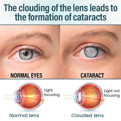 Medazy® Nano Eye Drops Serum —Nano Technology Restores Clear Vision,  No Glasses, No Surgery