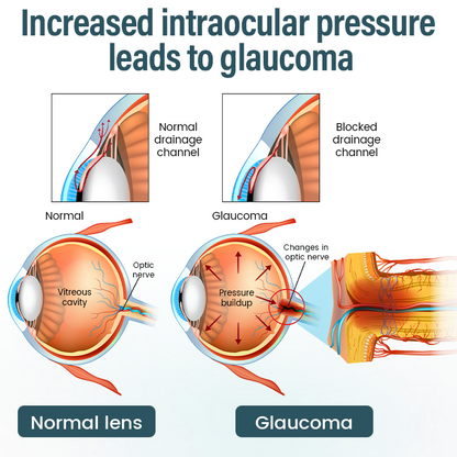 Medazy® Nano Eye Drops Serum —Nano Technology Restores Clear Vision,  No Glasses, No Surgery