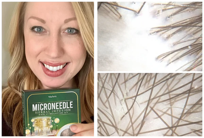 👱‍♂️ Medazy® Microneedle Herbal Infusion Hair Stimulation Set