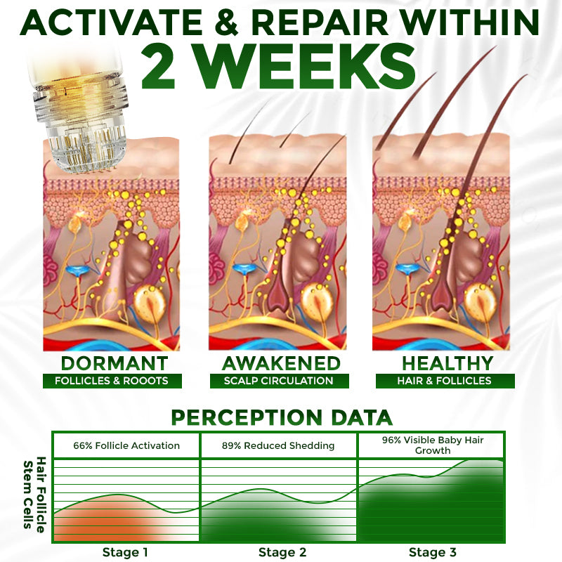 👱‍♂️ Medazy® Microneedle Herbal Infusion Hair Stimulation Set