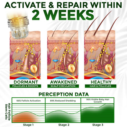 👱‍♂️ Medazy® Microneedle Herbal Infusion Hair Stimulation Set