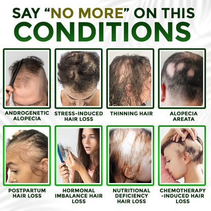 👱‍♂️ Medazy® Microneedle Herbal Infusion Hair Stimulation Set