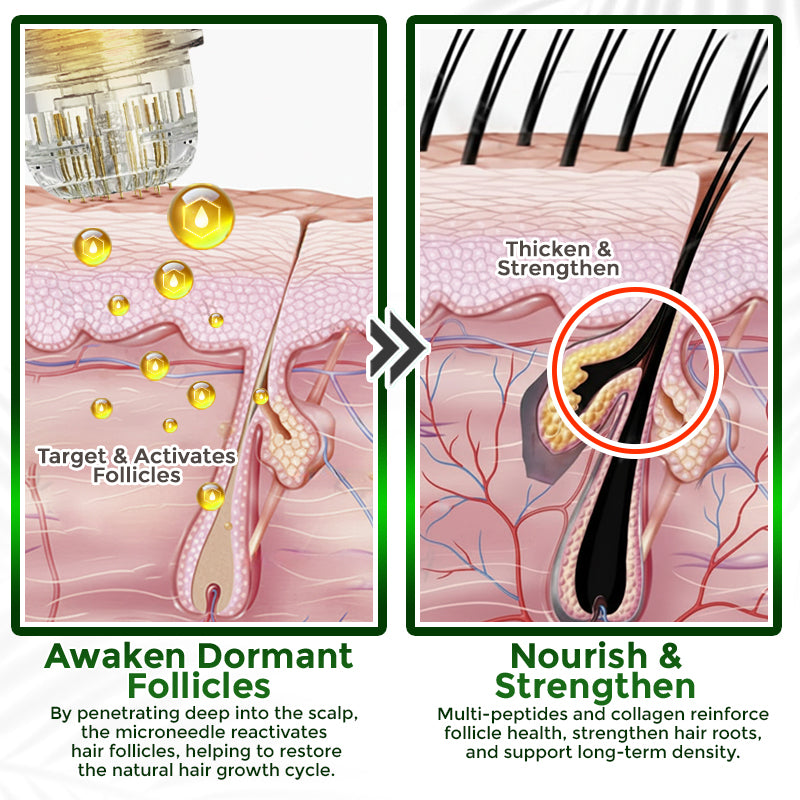 👱‍♂️ Medazy® Microneedle Herbal Infusion Hair Stimulation Set