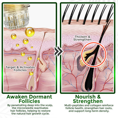 👱‍♂️ Medazy® Microneedle Herbal Infusion Hair Stimulation Set